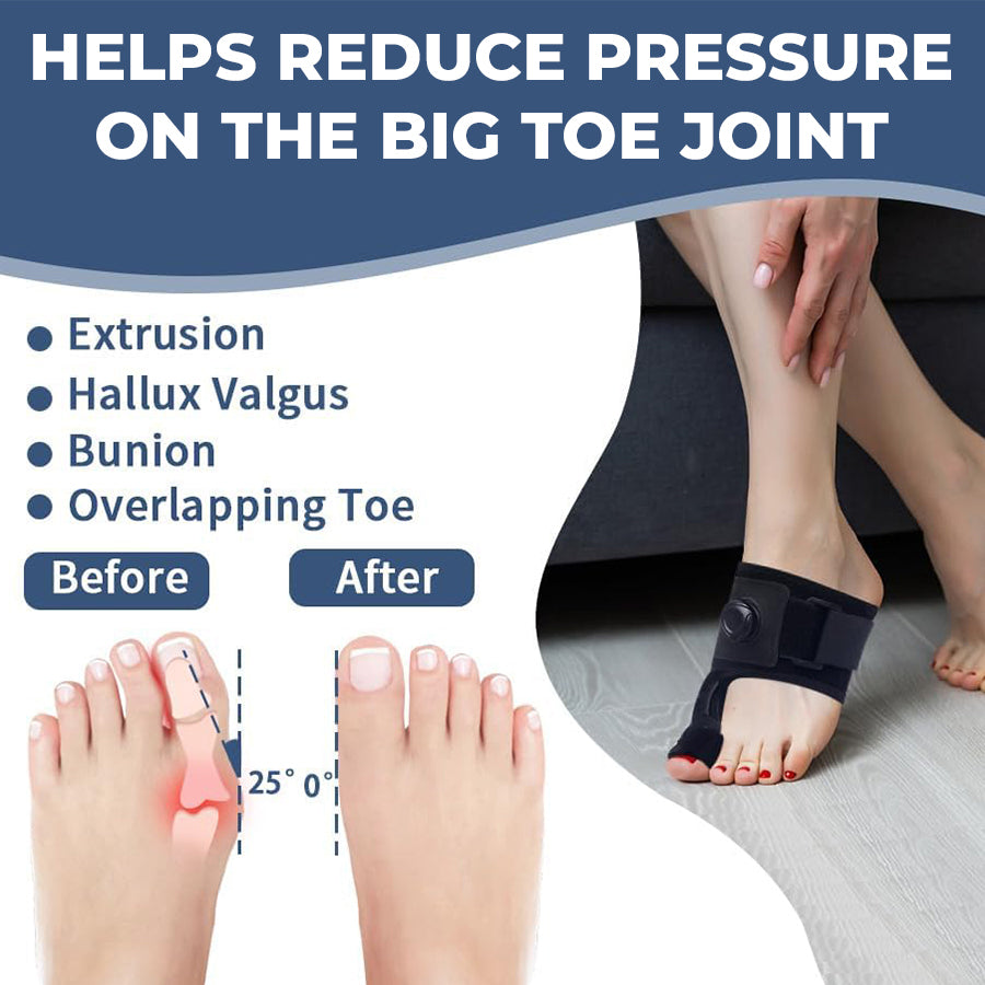 Walk More Comfortably Again — Adjustable Bunion Corrector Eases Toe Pain & Supports Realignment, Now 50% OFF