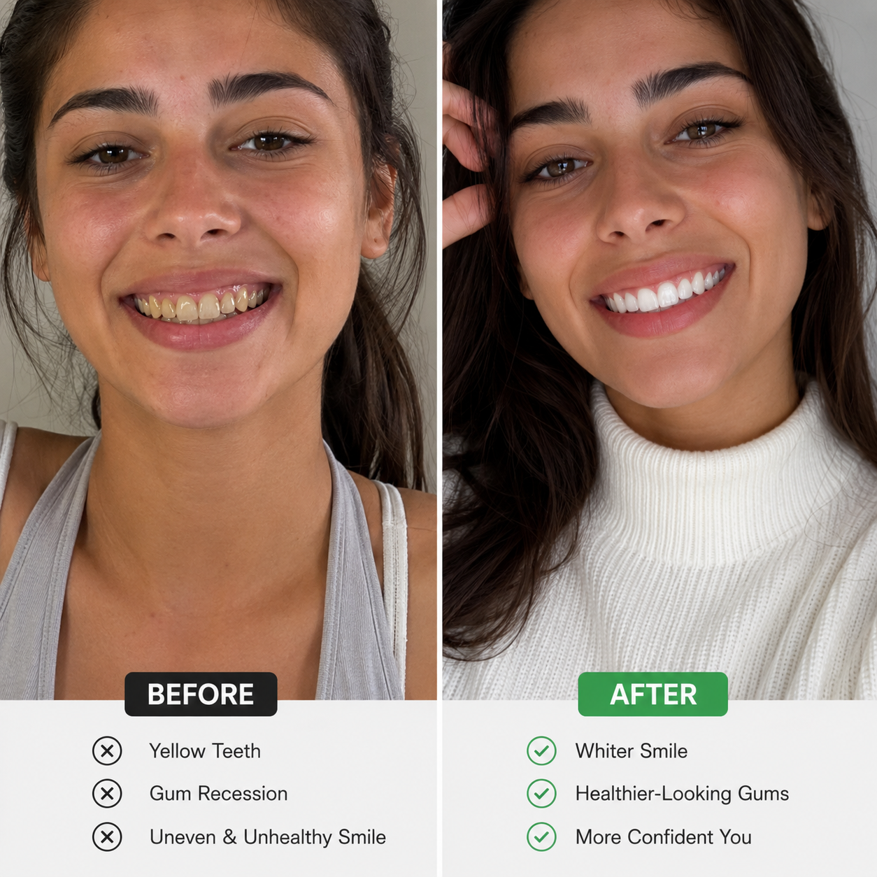 Illustrative before and after smile comparison